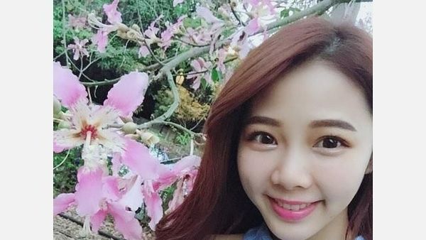 Foto: Pesona Ningxuan Chen, Asisten Dokter Gigi Cantik yang Viral