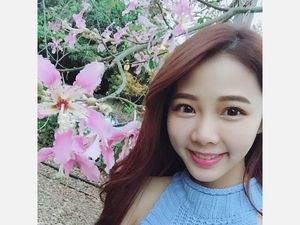 Foto: Pesona Ningxuan Chen, Asisten Dokter Gigi Cantik yang Viral