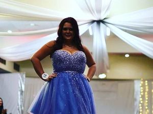 Payudara Wanita Ini Terus Tumbuh Hingga Ukuran Bra K