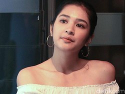 Besar di Sinetron, Mikha Tambayong Sempat Cicipi Kontrak Eksklusif?