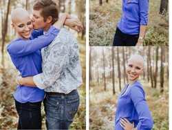 Wanita Ini Berani Tampil Botak dalam Foto Tunangan, Cantik Banget!