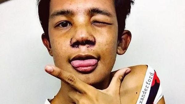 Bosan Dibully Soal Fisiknya, Artis Ini Nekat Operasi Plastik Wajahnya