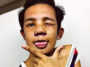 Bosan Dibully Soal Fisiknya, Artis Ini Nekat Operasi Plastik Wajahnya Bosan Dibully Soal Fisiknya, Artis Ini Nekat Operasi Plastik Wajahnya