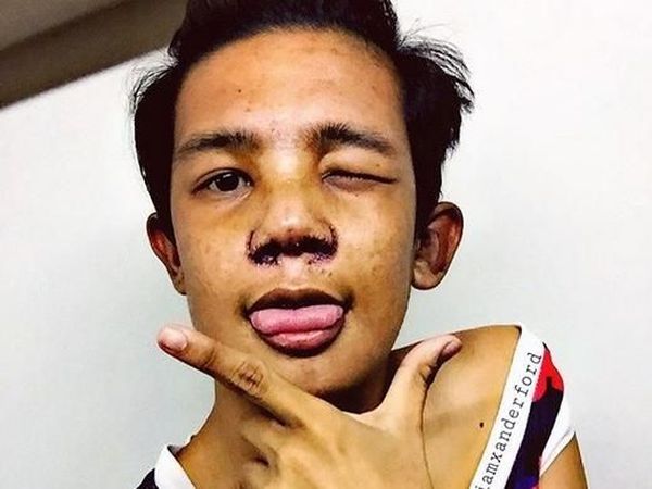 Bosan Dibully Soal Fisiknya, Artis Ini Nekat Operasi Plastik Wajahnya