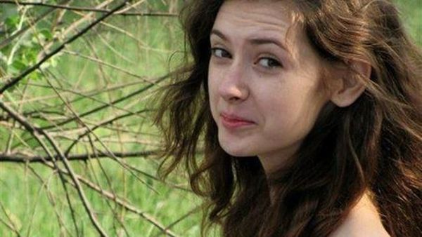 Foto: Wanita Cantik Ukraina Berleher Panjang Karena Sindrom Langka