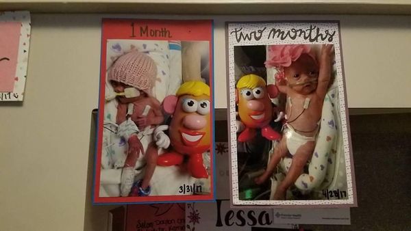 Potret Mr dan Mrs Potato Head Bantu Pantau Perkembangan Bayi Prematur