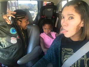 Kisah Sharekia, Tak Malu Sebut Dirinya Sapi Karena Vitiligo