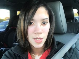 Sharekia dan Cara Uniknya untuk Kenalkan Vitiligo