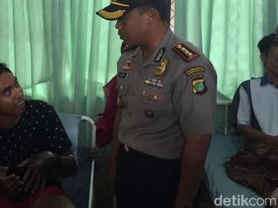 Foto: Kondisi Tangan 5 Murid Debus yang Cuci Tangan Pakai Air Keras