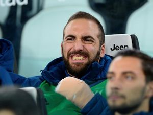 Jalani Operasi Jari, Higuain Diragukan Main Lawan Napoli
