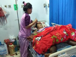 Terkena Penyakit Aneh, Kaki Heni asal Karawang Seperti Kayu