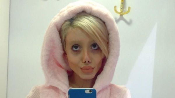 Foto: Ini Sahar, Wanita yang Viral karena Operasi Plastik Demi Mirip Jolie