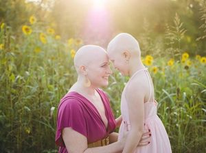 Cerita Haru di Balik Foto Ibu dan Anak yang Sama-Sama Botak