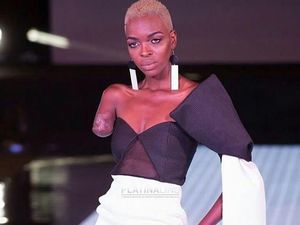 Lumenni Bombo, Wanita yang Punya Satu Lengan Ini Sukses Jadi Model