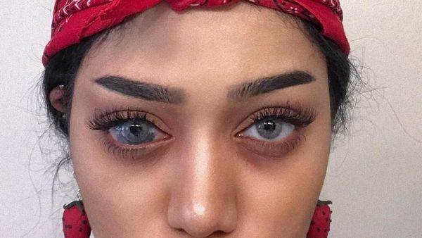 Potret Wanita Cantik dengan Tanda Lahir Unik di Mata