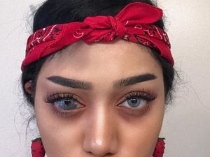 Potret Wanita Cantik dengan Tanda Lahir Unik di Mata