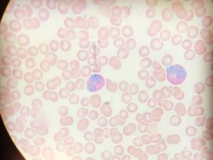 Foto: Ketika Sel Imun Tertangkap Lensa Mikroskop