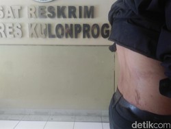 Begini Pengakuan Mahasiswa yang Ikut Diciduk Polisi Kulon Progo