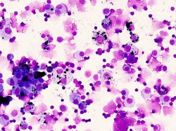 Jangan Menyerah pada Diri Sendiri! 1,8 Triliun Sel Imun Saja Membelamu