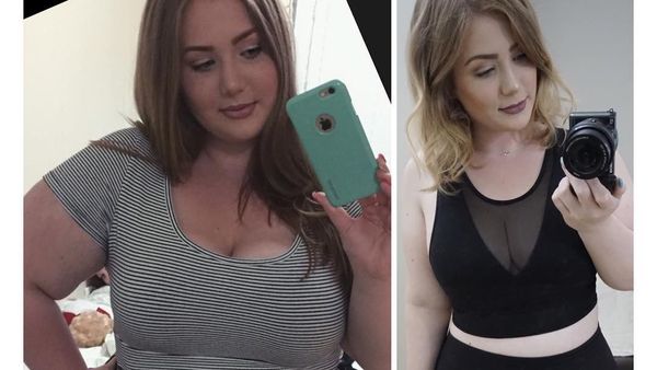 Foto: Transformasi Gadis Obesitas Turunkan Bobot Hingga 52 Kg