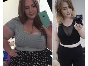 Foto: Transformasi Gadis Obesitas Turunkan Bobot Hingga 52 Kg