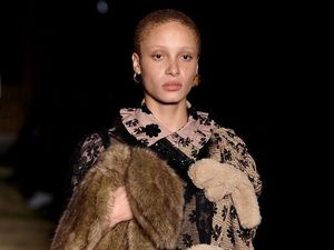 Kecantikan Unik Wanita Botak yang Kalahkan Gigi Hadid Jadi Model of The Year Kecantikan Unik Wanita Botak yang Kalahkan Gigi Hadid Jadi Model of The Year