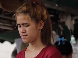 Pernah Dibully Mirip Penyihir, Tranformasi Wanita Oplas Ini Bikin Terpana