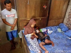 Duh, Sudah 3 Bulan Pipi Faiz Bengkak Akibat Tersengat Lebah