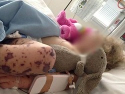 Terjadi Wabah, Pria Gay di Melbourne Diminta Suntik Vaksin Meningitis