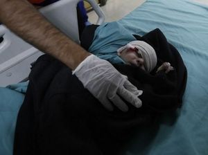 Foto: Balita Jadi Korban Serangan Balasan Israel untuk Roket dari Gaza