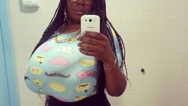 Mengaku Idap Gigantomastia, Wanita Ini Miliki Payudara Raksasa