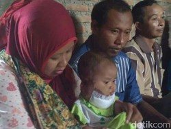 Menengok Bayi 6 Bulan Pengidap Kanker Kulit di Jepara