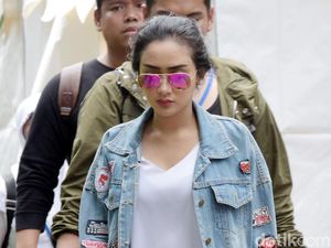 Ketiak Hitam Buat Cita Citata Malu karena Tak Sempat ke Dokter