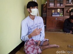 Menengok Andhika, Penderita Kanker Tulang yang Harus Diamputasi