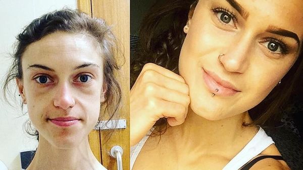 Potret Perjuangan Wanita yang Anoreksia Karena Takut Menjomblo