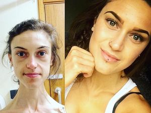 Potret Perjuangan Wanita yang Anoreksia Karena Takut Menjomblo