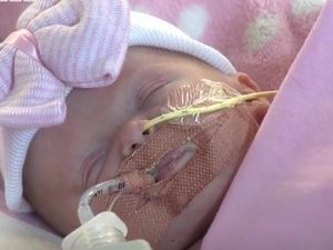 Kisah Haru Perjuangan Bayi yang Lahir dengan Jantung di Luar