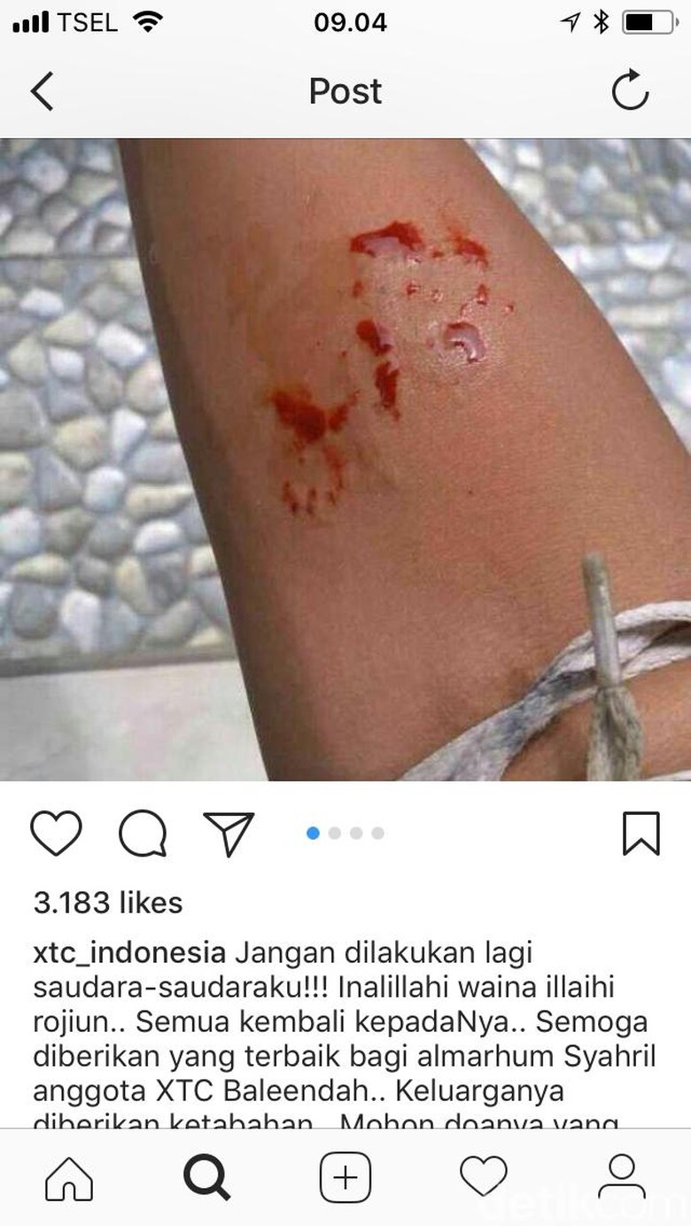 Viral, ABG di Bandung Tewas Dipatuk Ular King Kobra Peliharaannya Viral, ABG di Bandung Tewas Dipatuk Ular King Kobra Peliharaannya