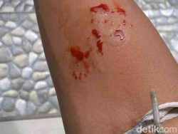 Viral, ABG di Bandung Tewas Dipatuk Ular King Kobra Peliharaannya