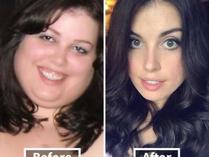 Drastis! Deretan Foto Selfie Sebelum dan Setelah Diet