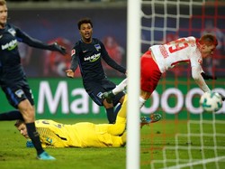 Tangan Pemain RB Leipzig Ini Patah akibat Cetak Gol