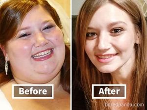 15 Transformasi Wajah Wanita Pasca Berat Badan Turun Drastis,  Beda Banget!