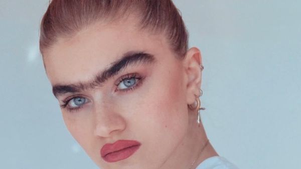 10 Wanita Ini Lawan Standar Kecantikan dengan Kondisi Uniknya