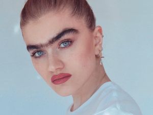 10 Wanita Ini Lawan Standar Kecantikan dengan Kondisi Uniknya 10 Wanita Ini Lawan Standar Kecantikan dengan Kondisi Uniknya