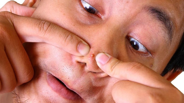 Bukan hanya problem hormon, benjol di area tertentu juga sanggup jadi tanda problem kesehatan. (Foto: ilustrasi/thinkstock) Bukan hanya problem hormon, benjol di area tertentu juga sanggup jadi tanda problem kesehatan. (Foto: ilustrasi/thinkstock)