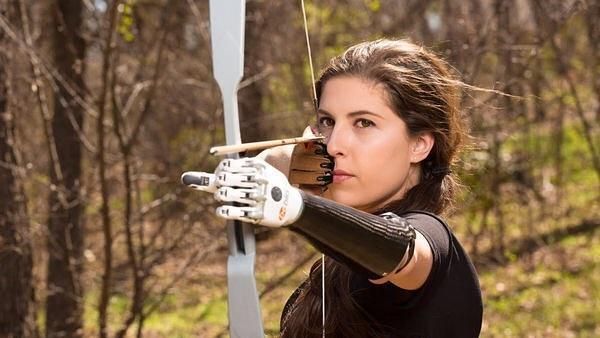 Angel Giuffria, Wanita Cantik dengan Lengan Prostetik yang Rajin Olahraga