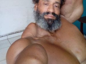 Foto Pria Berotot Karena Suntikan Minyak, Keren atau Seram?