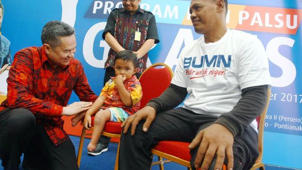 Melihat Kebahagiaan Para Penerima Kaki Palsu