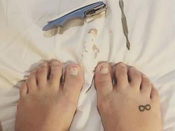 Kuku Perempuan Ini Rapuh Banget Saat Hamil, Apa Sebabnya Ya?