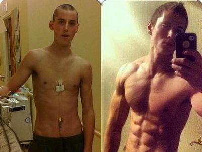 Foto: Transformasi Super, Dari Pasien Kanker Sampai Jadi Body Builder
